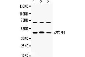 Western blot analysis of ARFGAP1 expression in rat brain extract ( Lane 1), mouse brain extract ( Lane 2) and HELA whole cell lysates ( Lane 3). (ARFGAP1 anticorps  (AA 1-183))
