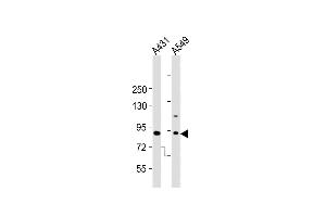All lanes : Anti-Dnmt3b Antibody  at 1:2000 dilution Lane 1: A431 whole cell lysates Lane 2: A549 whole cell lysates Lysates/proteins at 20 μg per lane. (DNMT3B anticorps  (AA 389-417))