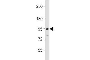 Western blot testing of human MCF7 cell lysate with TGFBR3 antibody at 1:2000.