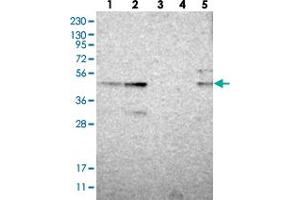 Western blot analysis of Lane 1: RT-4, Lane 2: U-251 MG, Lane 3: Human Plasma, Lane 4: Liver, Lane 5: Tonsil with ZNF397OS polyclonal antibody  at 1:250-1:500 dilution. (ZSCAN30 anticorps)
