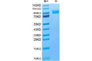 Cynomolgus M-CSF R on Tris-Bis PAGE under reduced condition.
