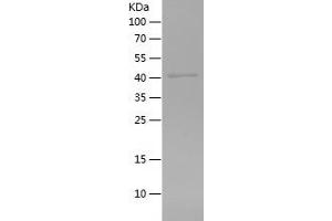 Western Blotting (WB) image for Alanyl (Membrane) Aminopeptidase (ANPEP) (AA 34-381) protein (His tag) (ABIN7121764)
