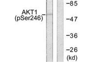 Western blot analysis of extracts from HeLa cells treated with Etoposide 25uM 24h, using Akt (Phospho-Ser246) Antibody. (AKT1 anticorps  (pSer246))