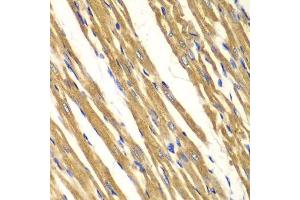 Immunohistochemistry of paraffin-embedded rat heart using SOD2 antibody.