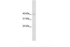 Image no. 1 for anti-Nudix (Nucleoside Diphosphate Linked Moiety X)-Type Motif 9 (NUDT9) (AA 121-170) antibody (ABIN6735454)