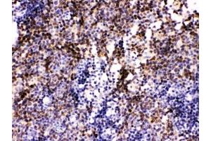 IHC testing of FFPE mouse lymph node with PAX2 antibody. (PAX2A anticorps)