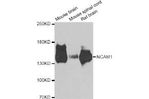 Western blot analysis of extracts of various cell lines, using NCAM1 antibody (ABIN5975670) at 1/1000 dilution. (CD56 anticorps)