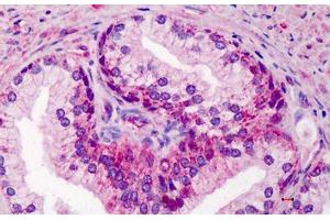 Human Prostate: Formalin-Fixed, Paraffin-Embedded (FFPE) (GDF15 anticorps  (AA 286-299))