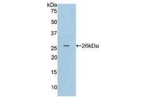 Detection of Recombinant FcgRI, Human using Polyclonal Antibody to Cluster Of Differentiation 64 (CD64) (FCGR1A anticorps  (AA 35-235))
