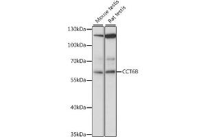 Western blot analysis of extracts of various cell lines, using CCT6B antibody (ABIN7270709) at 1:1000 dilution. (CCT6B anticorps  (AA 120-340))