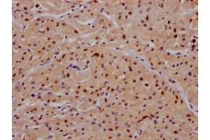 IHC image of ABIN7127654 diluted at 1:100 and staining in paraffin-embedded human heart tissue performed on a Leica BondTM system.