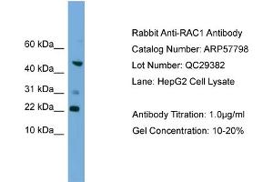 WB Suggested Anti-RAC1  Antibody Titration: 0.