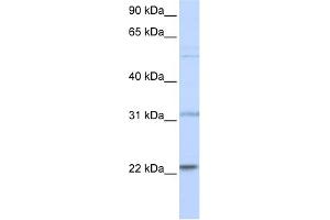 WB Suggested Anti-CDC42 Antibody Titration:  0. (CDC42 anticorps  (N-Term))
