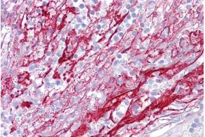 Immunohistochemistry with Tonsil tissue at an antibody concentration of 5µg/ml using anti-APOH antibody (ARP51159_P050)