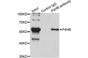 Immunoprecipitation analysis of 200ug extracts of SW620 cells using 3ug P4HB antibody. (P4HB anticorps)