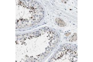 Immunohistochemical staining of human testis with C9orf11 polyclonal antibody  shows strong cap like cytoplasmic positivity in spermatids at 1:200-1:500 dilution. (C9orf11 anticorps)