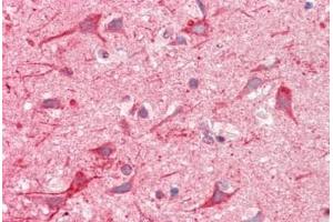 anti-Neurofilament, Light Polypeptide (NEFL) antibody