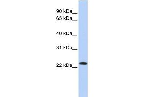 WB Suggested Anti-SDF2 Antibody Titration:  0. (SDF2 anticorps  (Middle Region))