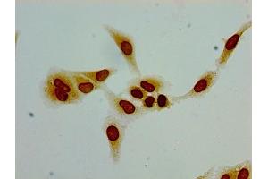 Immunocytochemistry analysis of Hela cells using ABIN7139207 at dilution of 1:100