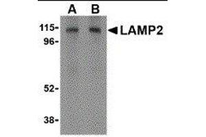 Western Blotting (WB) image for anti-Lysosomal-Associated Membrane Protein 2 (LAMP2) (C-Term) antibody (ABIN2478099) (LAMP2 anticorps  (C-Term))