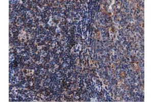 Immunohistochemical staining of paraffin-embedded Human lymph node tissue using anti-ARHGAP25 mouse monoclonal antibody.