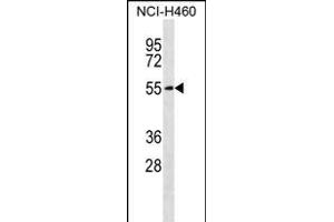 SLC16A3 Antibody (C-term) (ABIN656331 and ABIN2845630) western blot analysis in NCI- cell line lysates (35 μg/lane).