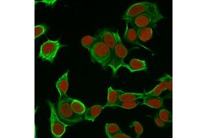 Immunofluorescence Analysis of MCF-7 cells labeling CK8 with Cytokeratin 8 Mouse Monoclonal Antibody (H1) followed by Goat anti-Mouse IgG-CF488 (Green).
