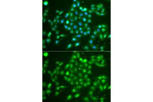 Immunofluorescence analysis of A549 cells using UCHL5 antibody (ABIN5975761). (UCHL5 anticorps)
