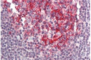 Human Small Intestine, Peyer's Patch (formalin-fixed, paraffin-embedded) stained with BIRC8 antibody ABIN214413 at 5 ug/ml followed by biotinylated goat anti-rabbit IgG secondary antibody ABIN481713, alkaline phosphatase-streptavidin and chromogen. (ILP-2 anticorps  (N-Term))