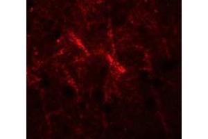 Immunofluorescence of SIPA1 in human brain cells with SIPA1 antibody at 20 ug/mL.