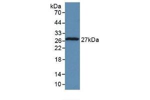 Detection of Recombinant TPT1, Human using Monoclonal Antibody to Tumor Protein, Translationally Controlled 1 (TPT1) (TPT1 anticorps  (AA 1-172))