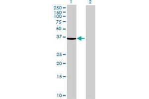 Western Blot analysis of EPM2A expression in transfected 293T cell line ( H00007957-T01 ) by EPM2A MaxPab polyclonal antibody. (EPM2A anticorps  (AA 1-331))
