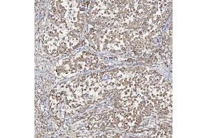 IHC analysis of ACAD9 using anti-ACAD9 antibody (ABIN7602670).