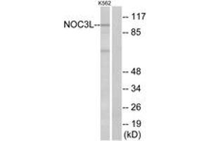 Western blot analysis of extracts from K562 cells, using NOC3L Antibody. (NOC3L anticorps  (AA 415-464))