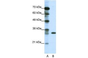 WB Suggested Anti-TSFM  Antibody Titration: 1. (TSFM anticorps  (C-Term))