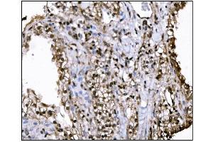 IHC analysis of KMT1B/SUV39H2 using anti-KMT1B/SUV39H2 antibody (ABIN7602135). (SUV39H2 anticorps  (AA 6-410))