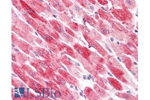 ABIN185454 (3. (Cofilin 2 anticorps  (C-Term))