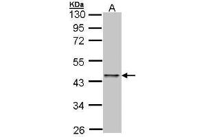 WB Image Sample (30 ug of whole cell lysate) A: A431 , 10% SDS PAGE antibody diluted at 1:500 (E2F1 anticorps)
