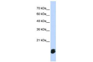 GLRX5 antibody used at 1 ug/ml to detect target protein. (GLRX5 anticorps  (Middle Region))
