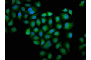 Immunofluorescence staining of Hela cells with ABIN7153749 at 1:100, counter-stained with DAPI.
