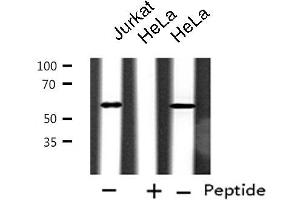 Western blot analysis of extracts from Jurkat/HeLa cells, using CYP2A6V2 antibody. (Cytochrome P450 2A6V2 anticorps)