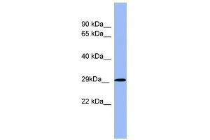 WB Suggested Anti-RAB5A Antibody Titration: 0.