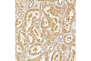 Immunohistochemistry of paraffin-embedded rat kidney using USP9Y Rabbit pAb (ABIN7271171) at dilution of 1:150 (40x lens). (USP9Y anticorps)