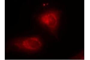 Image no. 3 for anti-Nuclear Factor of kappa Light Polypeptide Gene Enhancer in B-Cells Inhibitor, alpha (NFKBIA) (Ser32), (Ser36) antibody (ABIN197304)