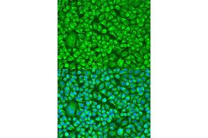 Immunofluorescence analysis of U2OS cells using TUBB8 antibody.