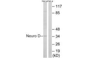 Western blot analysis of extracts from HeLa cells, using Neuro D (Ab-274) antibody. (NEUROD1 anticorps  (Ser272))