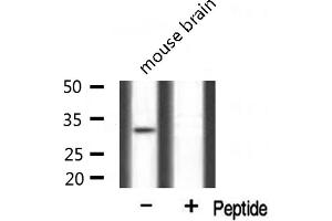 Western blot analysis of extracts from mouse brain, using Mlx antibody.