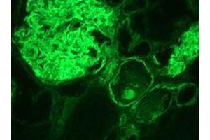 Immunohistochemistry on frozen section of human kidney (Integrin alpha 3a anticorps)