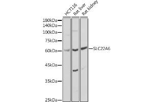 Western blot analysis of extracts of various cell lines, using SLC22 antibody (ABIN3022596, ABIN3022597, ABIN3022598 and ABIN6218932) at 1:1000 dilution. (SLC22A6 anticorps)