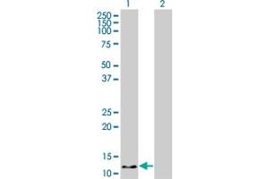Western Blot analysis of HBZ expression in transfected 293T cell line by HBZ monoclonal antibody (M03), clone 1G10.